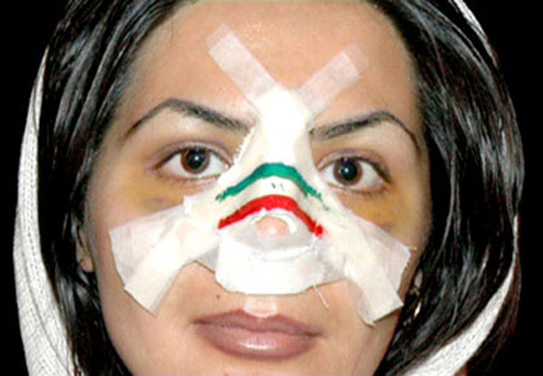 حجاب اجباری با زنان و دختران ایرانی چه کرده است؟/مجید محمدی