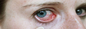 التهابات چشمی/دکتر عطا انصاری
