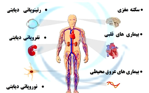 مشکلاتی که دیابت تولید می کند/دکتر عطا انصاری