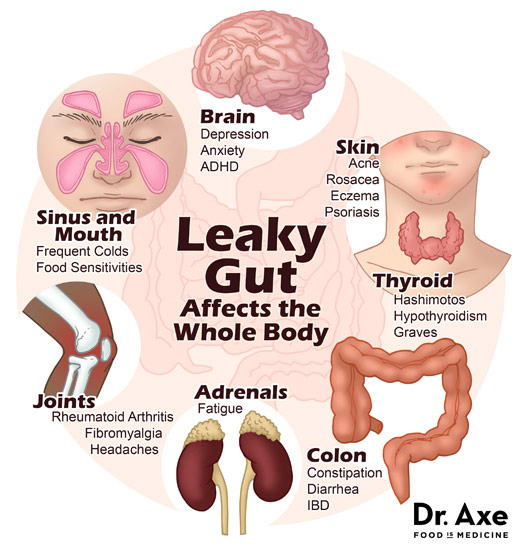 leaky-gut