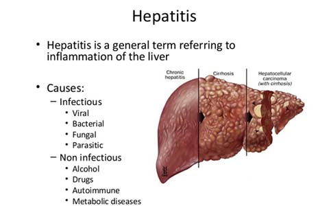 هپاتیت های A و B و C و سمّی/ دکتر عطا انصاری