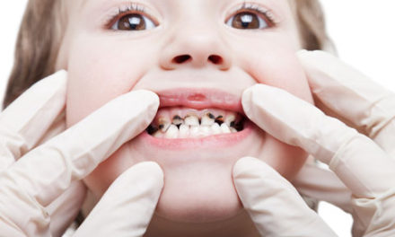 پوسیدگی یا کرم خوردگی دندان/دکتر عطا انصاری